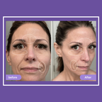 Elvoriah Sculpt & Glow Device + 30-Day Transformation Program