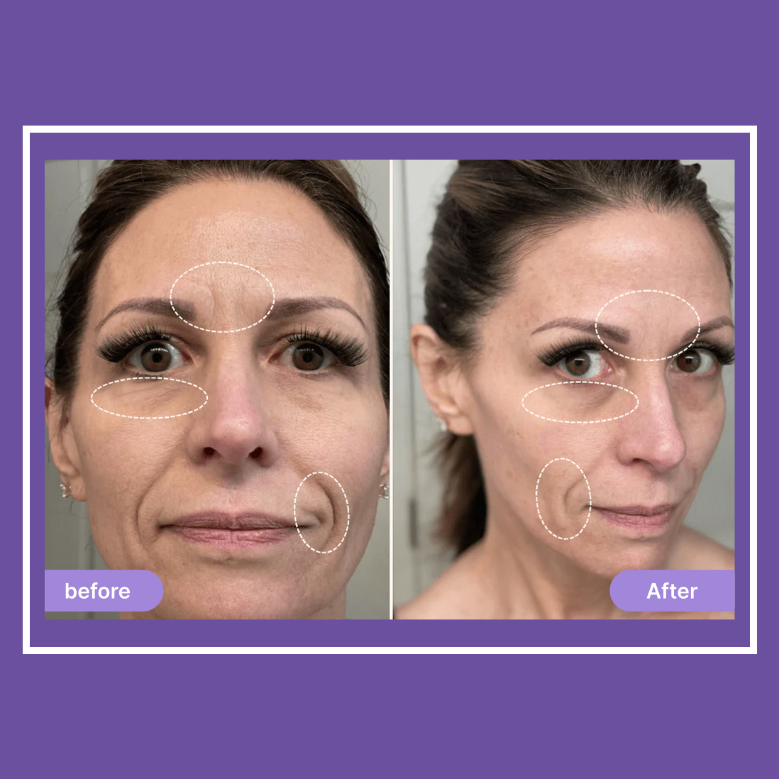 Elvoriah Sculpt & Glow Device + 30-Day Transformation Program