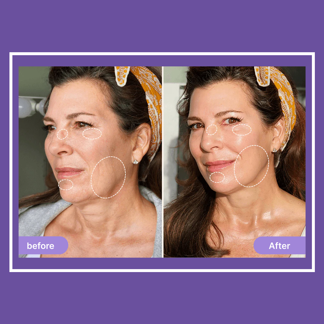Elvoriah Sculpt & Glow Device + 30-Day Transformation Program
