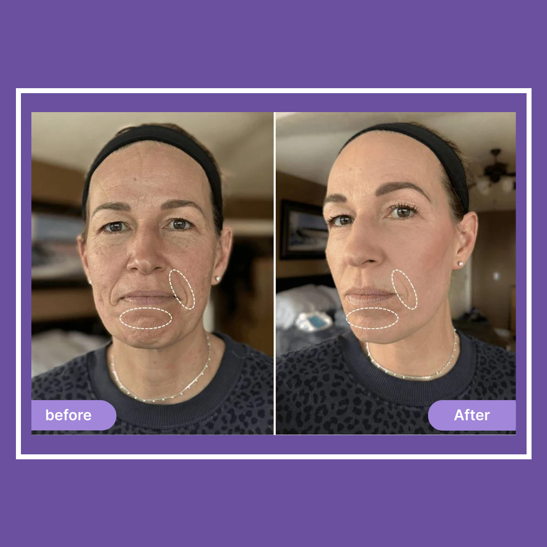 Elvoriah Sculpt & Glow Device + 30-Day Transformation Program