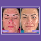 Elvoriah Sculpt & Glow Device + 30-Day Transformation Program