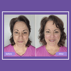 Elvoriah Sculpt & Glow Device + 30-Day Transformation Program