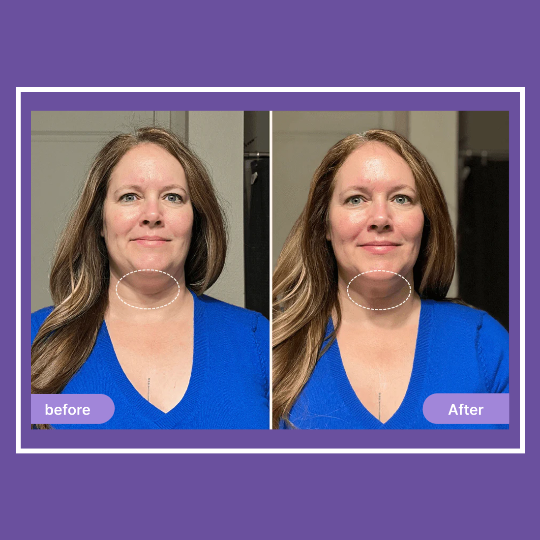 Elvoriah Sculpt & Glow Device + 30-Day Transformation Program