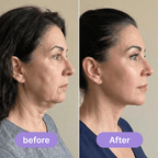 Elvoriah Sculpt & Glow Device + 30-Day Transformation Program